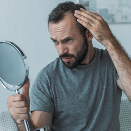 Quels compléments alimentaires utiliser en cas de chute de cheveux ?